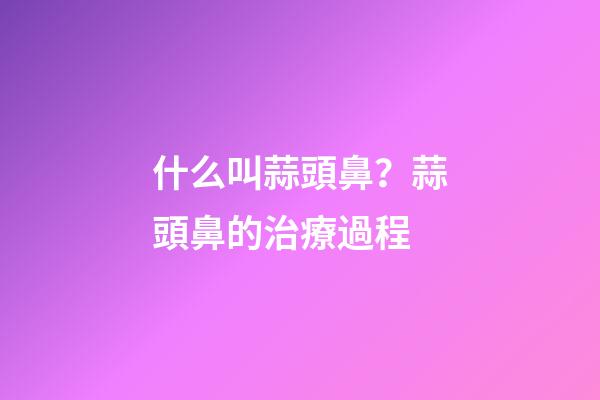什么叫蒜頭鼻？蒜頭鼻的治療過程