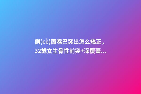 側(cè)面嘴巴突出怎么矯正，32歲女生骨性前突+深覆蓋Ⅲ度-第1張-觀點(diǎn)-玄機(jī)派