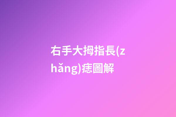 右手大拇指長(zhǎng)痣圖解