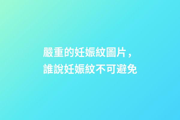 嚴重的妊娠紋圖片，誰說妊娠紋不可避免-第1張-觀點-玄機派