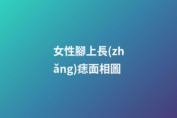女性腳上長(zhǎng)痣面相圖