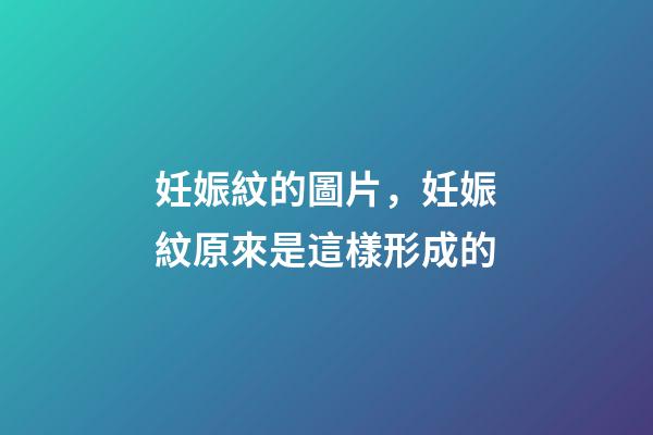 妊娠紋的圖片，妊娠紋原來是這樣形成的-第1張-觀點-玄機派