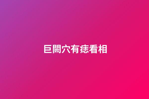 巨闕穴有痣看相