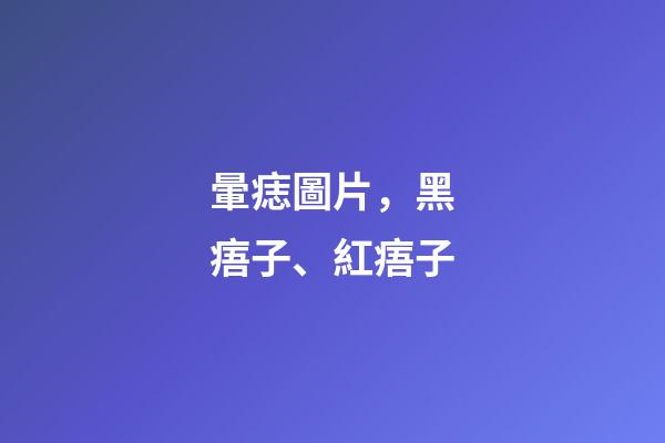 暈痣圖片，黑痦子、紅痦子-第1張-觀點-玄機派