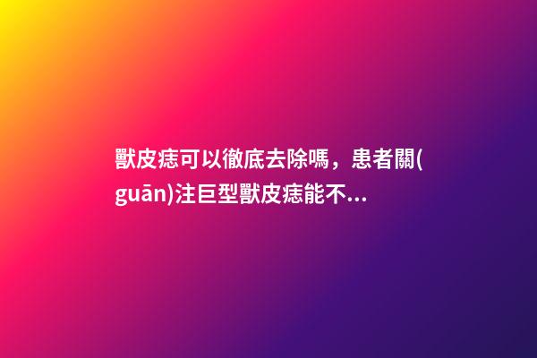 獸皮痣可以徹底去除嗎，患者關(guān)注巨型獸皮痣能不能治療-第1張-觀點(diǎn)-玄機(jī)派