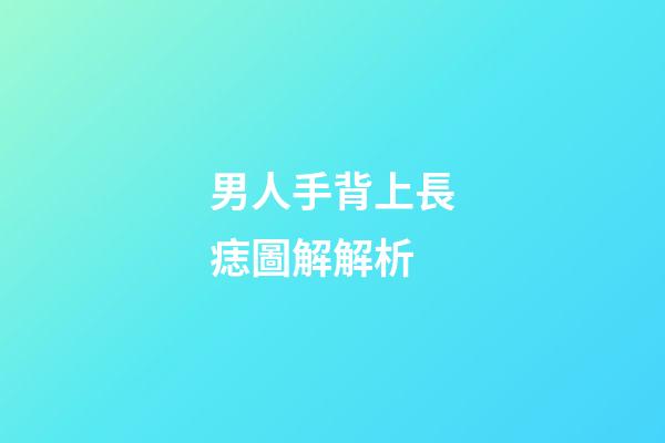 男人手背上長痣圖解解析