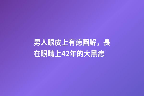 男人眼皮上有痣圖解，長在眼睛上42年的大黑痣-第1張-觀點-玄機派