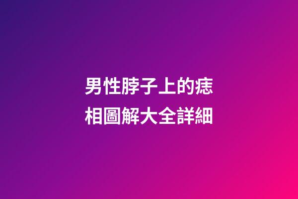 男性脖子上的痣相圖解大全詳細