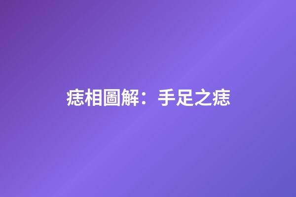 痣相圖解：手足之痣