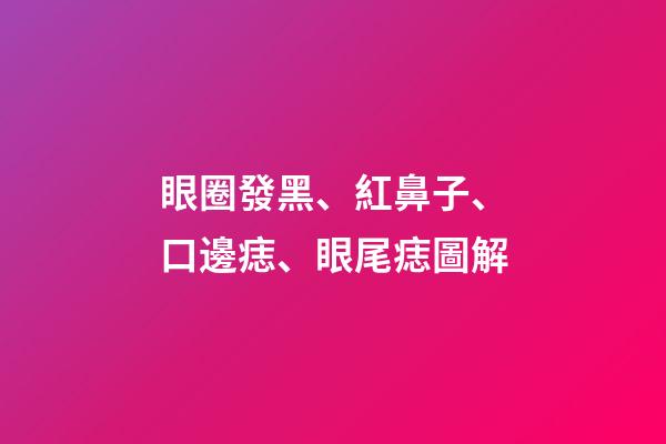 眼圈發黑、紅鼻子、口邊痣、眼尾痣圖解