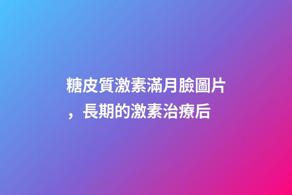 糖皮質激素滿月臉圖片，長期的激素治療后-第1張-觀點-玄機派
