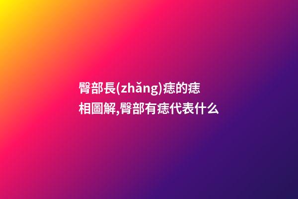 臀部長(zhǎng)痣的痣相圖解,臀部有痣代表什么