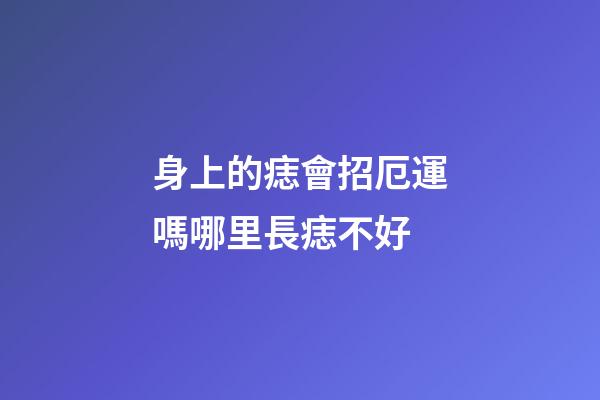 身上的痣會招厄運嗎?哪里長痣不好?
