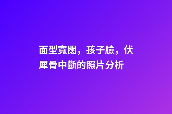 面型寬闊，孩子臉，伏犀骨中斷的照片分析