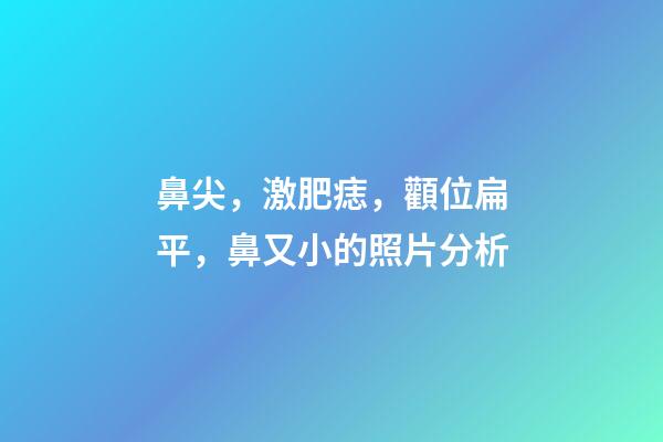 鼻尖，激肥痣，顴位扁平，鼻又小的照片分析